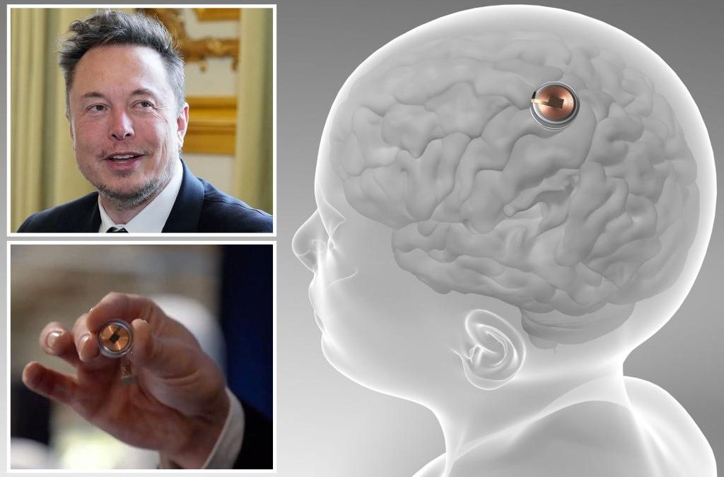 FDA approves Elon Musk’s Neuralink implants for humans test