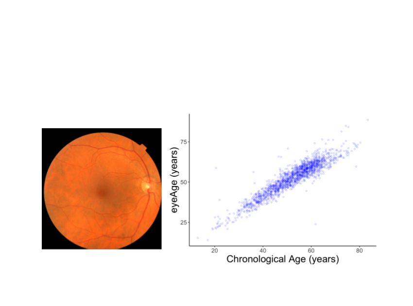 Developing an aging clock using deep learning on retinal images