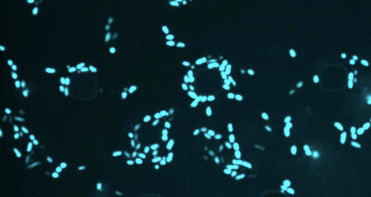 When an antibiotic fails: MIT scientists are using AI to target “sleeper” bacteria