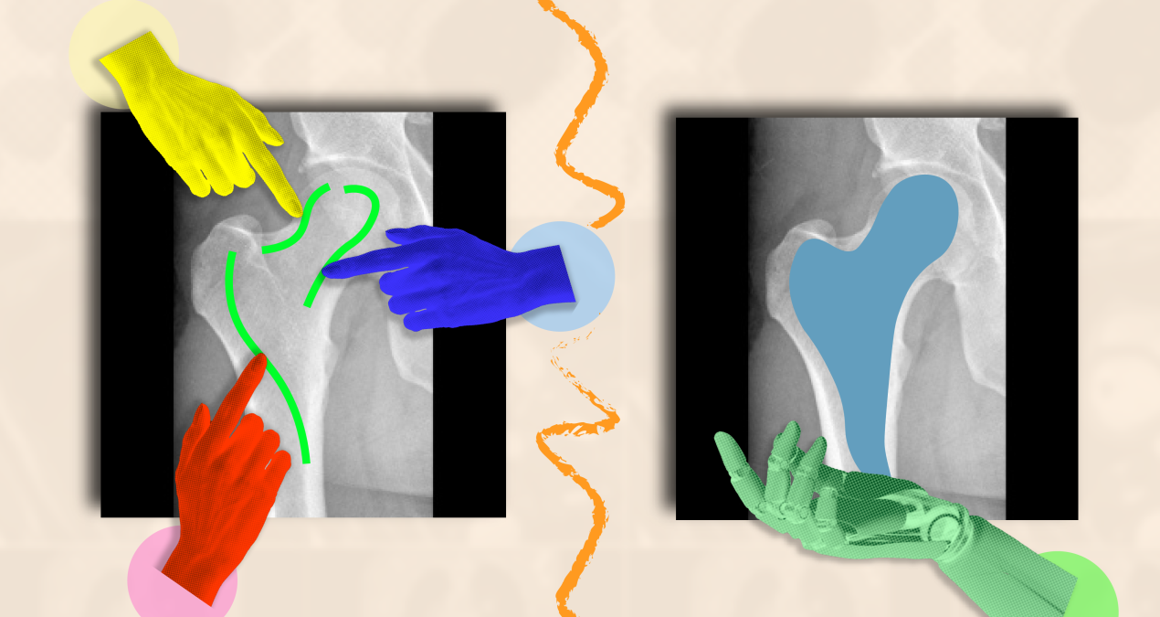 A fast and flexible approach to help doctors annotate medical scans