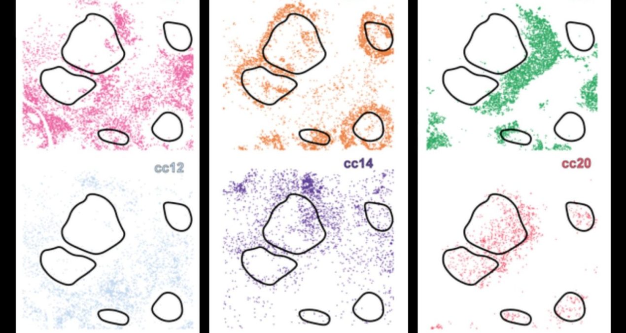 New AI system uncovers hidden cell subtypes, boosts precision medicine